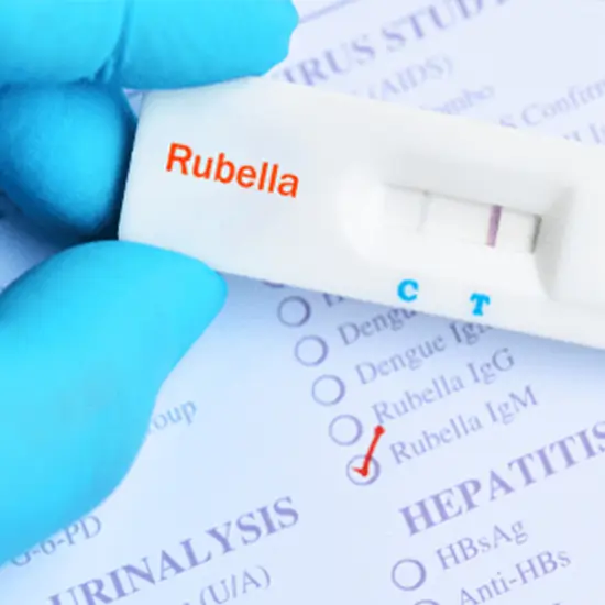 rubella igm test